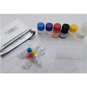 大鼠胰蛋白酶原激活肽(TAP)快速檢測(cè)ELISA試劑盒,Rat TAP (Trypsinogen Activation Peptide) QuickTest ELISA Kit