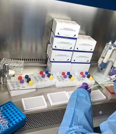 乙型肝炎病毒B型染料法熒光定量PCR試劑盒,Hepatitis B Virus(HBV)