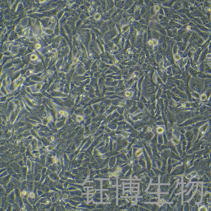 HOS（人骨肉瘤細(xì)胞）YB-71360HC,HOS