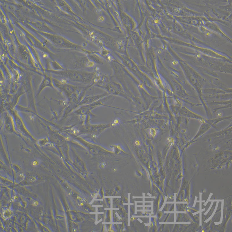 HGF-1（人牙齦成纖維細胞）YB-71356HC,HGF-1