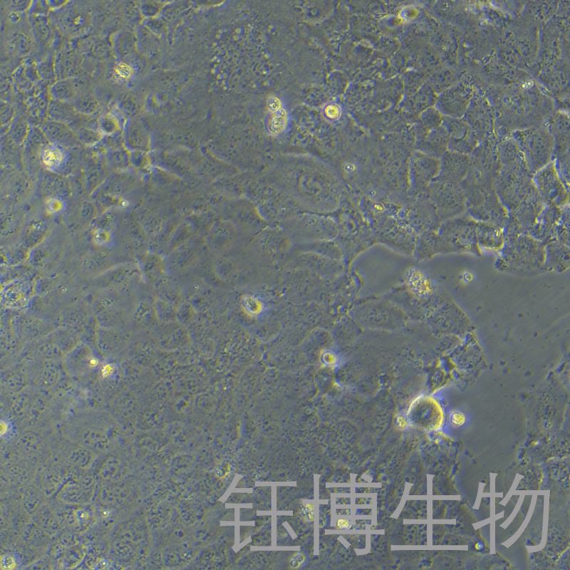 PLC/PRF/5（人肝癌亚力山大细胞）YB-71415HC,PLC/PRF/5