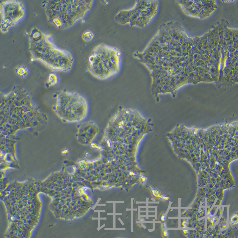 RT4（人膀胱移行細胞乳頭瘤細胞）YB-71431HC,RT4