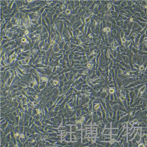 HOS（人骨肉瘤細(xì)胞）YB-71360HC