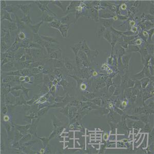 HCC38（人乳腺導(dǎo)管癌細(xì)胞）YB-71347HC