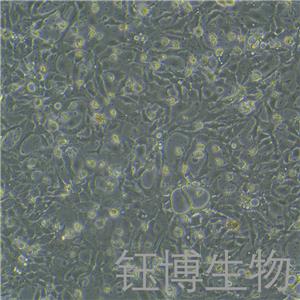 BT-20（人乳腺癌細(xì)胞）YB-71324HC