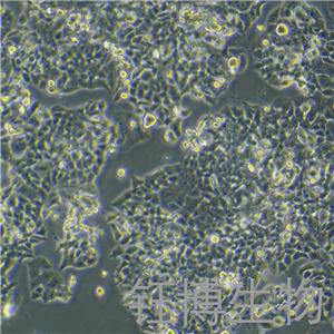 NCI-H520（人肺鳞癌细胞）YB-71402HC