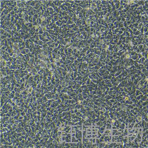 PA-1（人卵巢畸胎瘤細(xì)胞）YB-71411HC