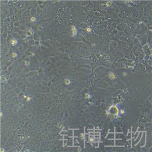 PLC/PRF/5（人肝癌亚力山大细胞）YB-71415HC,PLC/PRF/5