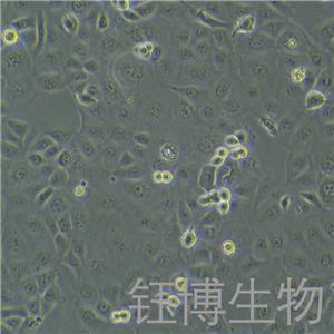 SF763（人脑瘤细胞）YB-71437HC