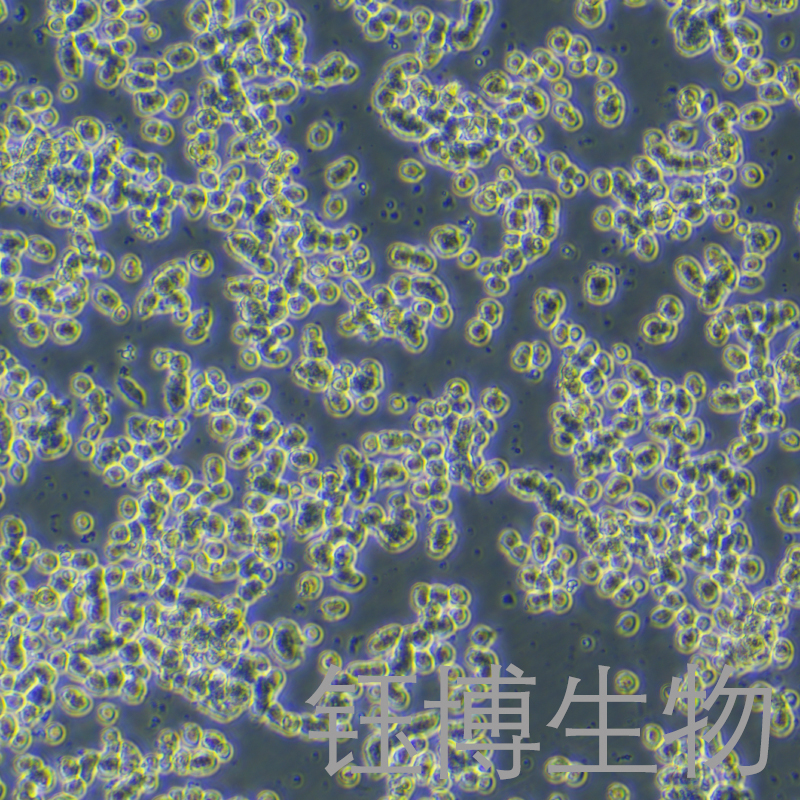 SK-NEP-1（人腎母細(xì)胞瘤細(xì)胞）YB-71442HC,SK-NEP-1