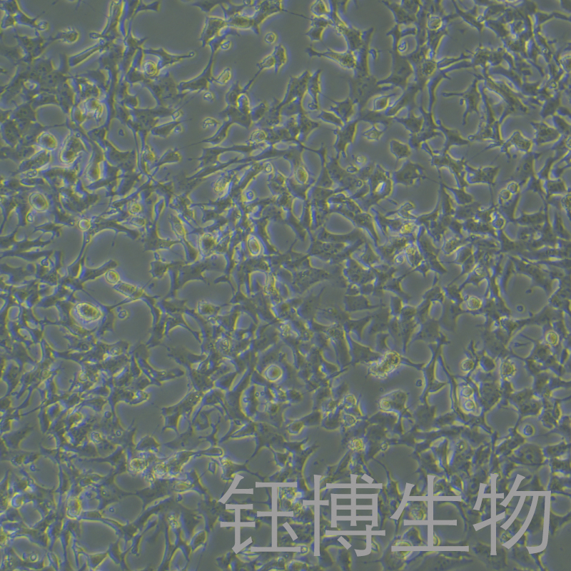 SK-N-MC（人神经上皮瘤细胞）YB-71443HC,SK-N-MC