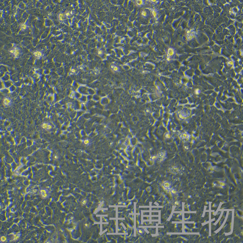 TE-10（人食管癌細(xì)胞）YB-71453HC,TE-10