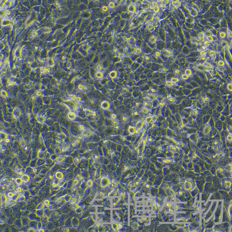 TE-11（人食管癌細(xì)胞）YB-71454HC,TE-11