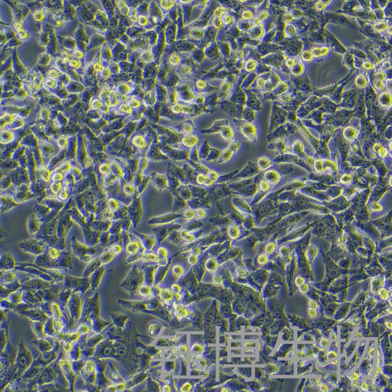 UM-UC-3（人膀胱移行細(xì)胞癌）YB-71463HC,UM-UC-3