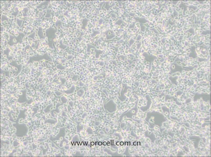 293E細胞 (人胚腎細胞(EBNA1基因修飾))(STR鑒定正確)CL-0311,293E Cells Line;293 c18;293c18;HEK 293 c18;HEK-293 c18;HEK293-EBNA1;HEK-293-EBNA;HEK 293-EBNA;HEK 293 EBNA;HEK293EBNA;293 EBNA;293-EBNA1;293-EBNA;293/EBNA;293EBNA;EBNA-293;EBNA293;293E;HEK293E;HEK/EBNA;HEK-EBNA;HEK.EBNA;293/EBNA-1