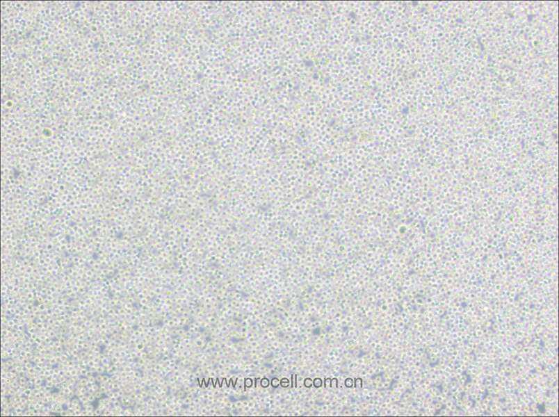 BALL-1细胞 (人B淋巴细胞急性白血病) (STR鉴定正确)CL-0587,BALL-1 Cells Line;Ball-1;Ball 1;BALL1;B-cell Acute Lymphoblastic Leukemia-1