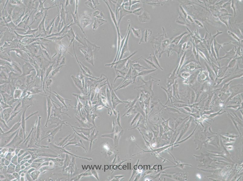 NCI-H1648细胞 (人肺癌腺癌细胞) (STR鉴定正确)CL-0764,NCI-H1648 Cells Line  ;H1648;H-1648;NCIH1648