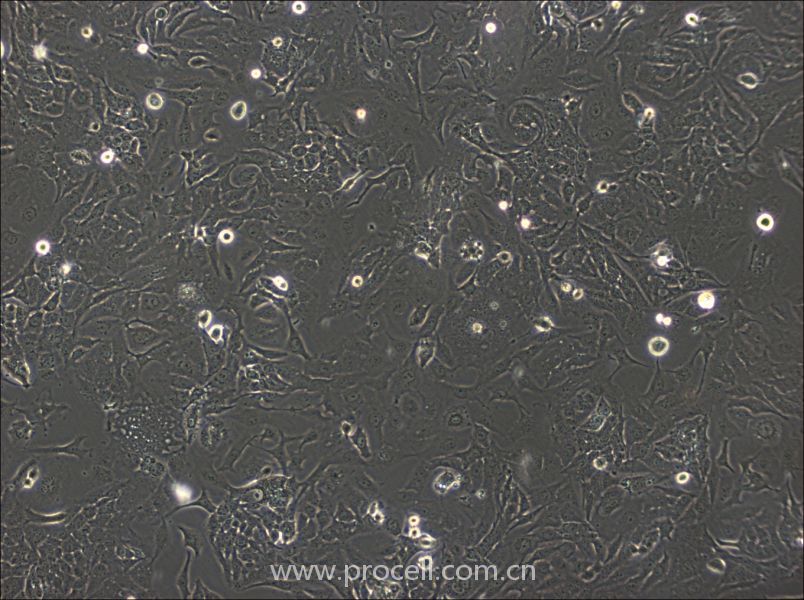 SK-GT-4細胞 (人食道癌腫瘤細胞) (STR鑒定正確)CL-0874,SK-GT-4 Cells Line  ;SKGT4;SK4