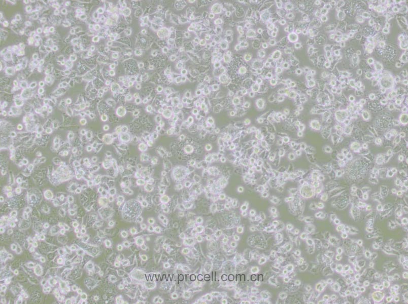 DH82細(xì)胞 (犬巨噬細(xì)胞/狗腎惡性組織細(xì)胞增生癥細(xì)胞)(種屬鑒定正確)CL-0073,DH82 Cells Line ;DH-82;DH 82