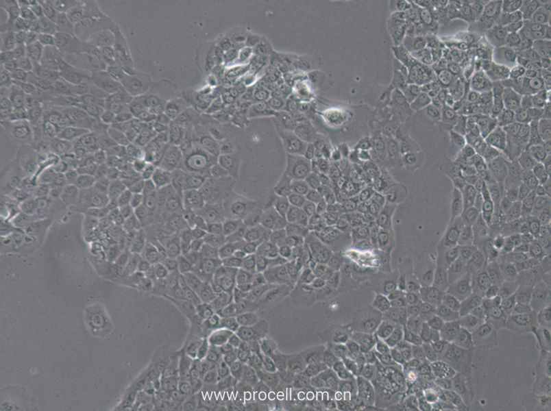 HT-3細胞 (人子宮頸癌細胞) (STR鑒定正確)CL-0630,HT-3 Cells Line;HT3