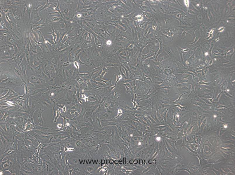 OK細(xì)胞 (負(fù)鼠腎細(xì)胞) (種屬鑒定正確)CL-0175,OK Cells Line  ;Opossum Kidney;OK-WT