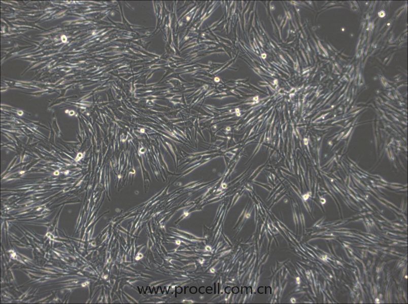 MeWo细胞 (人恶性黑色素瘤细胞) (STR鉴定正确)CL-0877,MeWo Cells Line;MEWO;Mewo;Me Wo;Me-Wo;Mevo;SK-MEL-MeWo;Mel-MeWo;BI-Mel;EST50