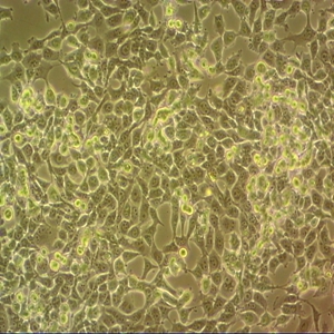 HEC-6人子宫内膜腺癌细胞,HEC-6