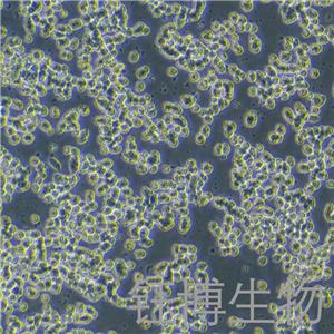 SK-NEP-1（人腎母細胞瘤細胞）YB-71442HC