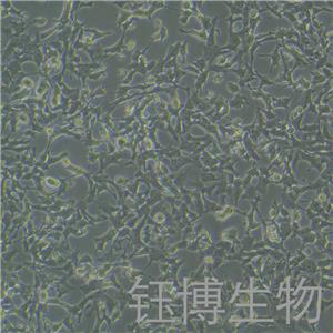 SK-N-MC（人神經(jīng)上皮瘤細(xì)胞）YB-71443HC