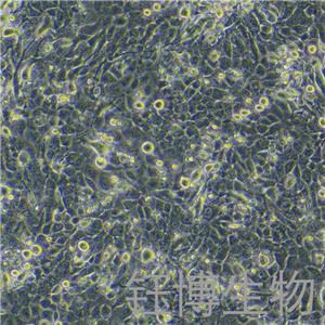 TE-11（人食管癌細(xì)胞）YB-71454HC,TE-11