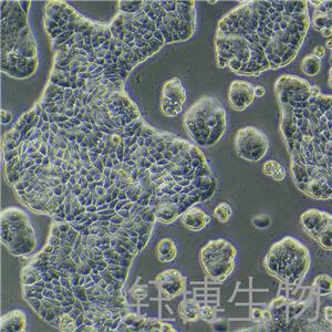 UACC-812（人乳腺導(dǎo)管瘤細胞）YB-71461HC