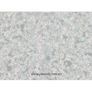 293E細胞 (人胚腎細胞(EBNA1基因修飾))(STR鑒定正確)CL-0311,293E Cells Line;293 c18;293c18;HEK 293 c18;HEK-293 c18;HEK293-EBNA1;HEK-293-EBNA;HEK 293-EBNA;HEK 293 EBNA;HEK293EBNA;293 EBNA;293-EBNA1;293-EBNA;293/EBNA;293EBNA;EBNA-293;EBNA293;293E;HEK293E;HEK/EBNA;HEK-EBNA;HEK.EBNA;293/EBNA-1