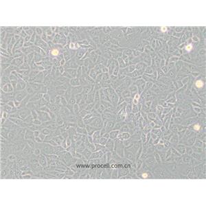 Mahlavu細(xì)胞 (人肝癌細(xì)胞) (STR鑒定正確)CL-0735