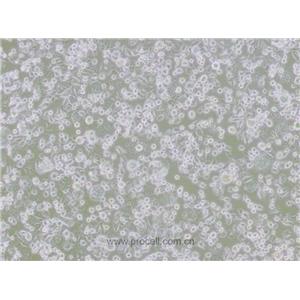 DH82細(xì)胞 (犬巨噬細(xì)胞/狗腎惡性組織細(xì)胞增生癥細(xì)胞)(種屬鑒定正確)CL-0073,DH82 Cells Line ;DH-82;DH 82