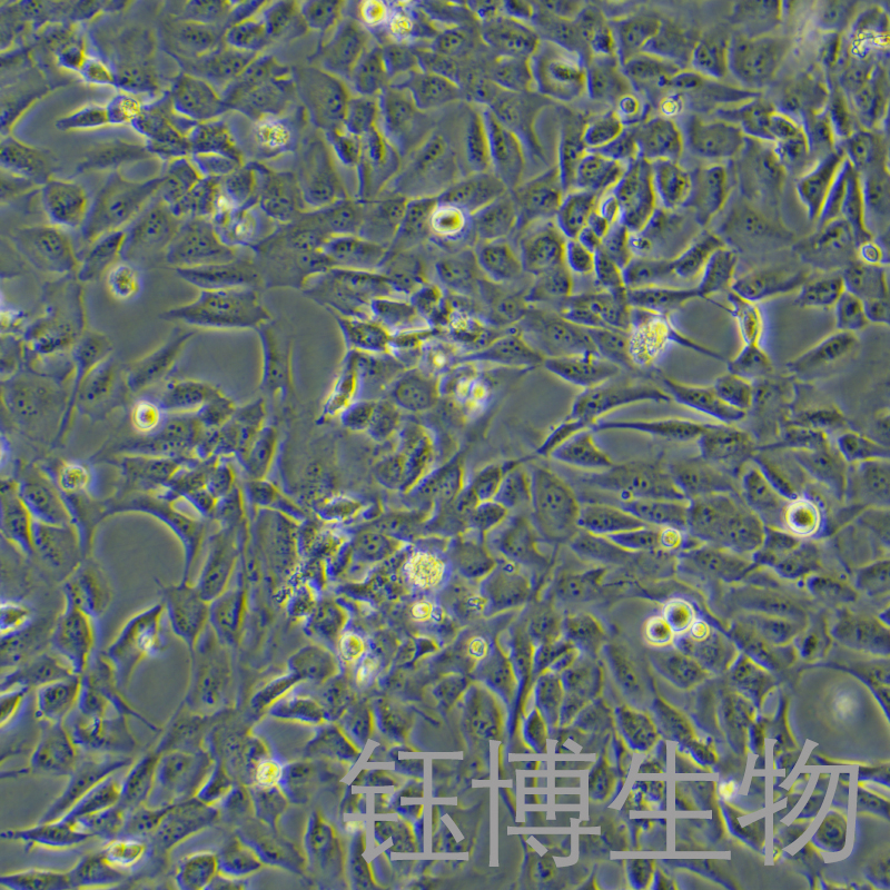 WPMY-1（人正常前列腺基質(zhì)永生化細胞）YB-71467HC,WPMY-1