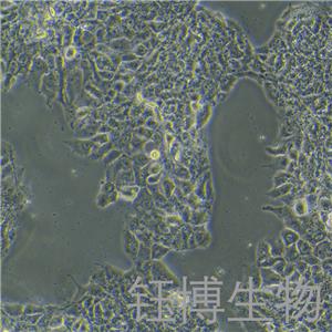 Bewo（人絨毛膜腫瘤細(xì)胞）YB-71500HC