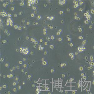 NCI-H929（人骨髓瘤細(xì)胞）YB-71509HC