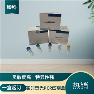 支原體通用型/內(nèi)參(MYCO-U/NB1)核酸檢測(cè)試劑盒(雙重?zé)晒?PCR法)