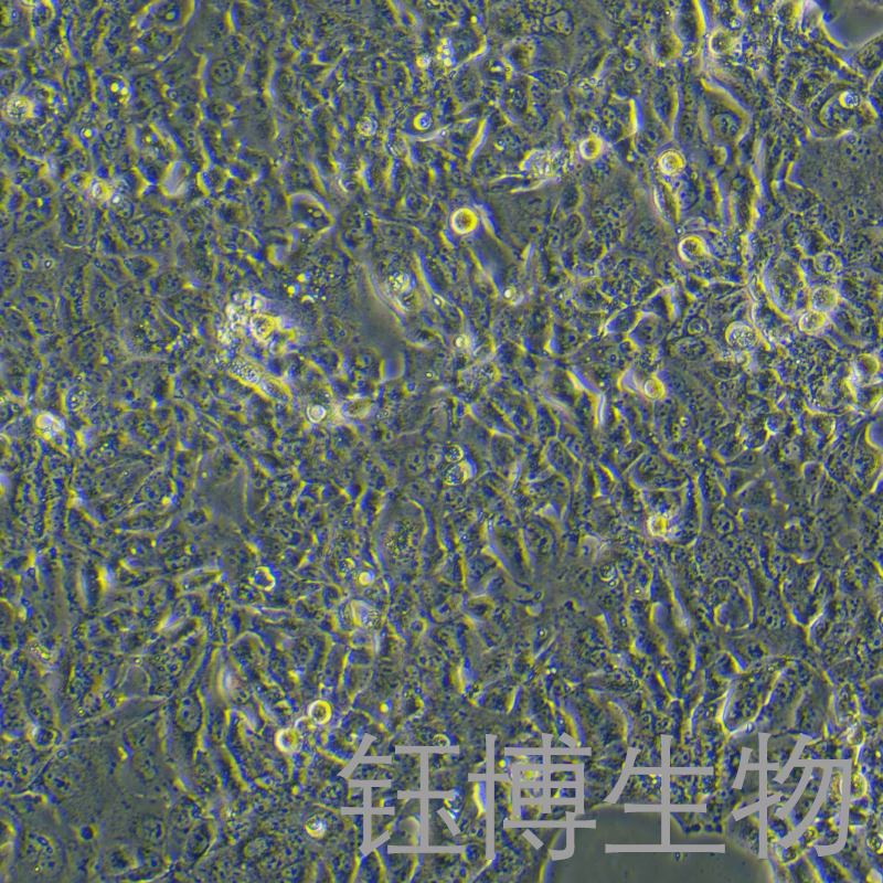 NCI-H441（人肺腺癌細(xì)胞）YB-71514HC,NCI-H441