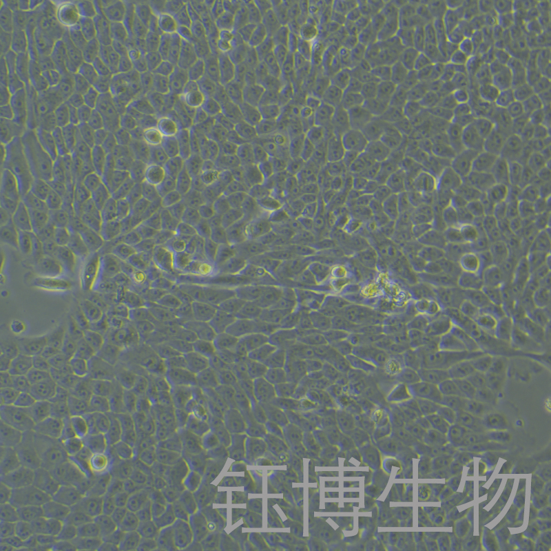 MCF 10A（人正常乳腺上皮細(xì)胞）YB-71525HC,MCF 10A