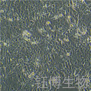 NCI-H441（人肺腺癌細(xì)胞）YB-71514HC,NCI-H441