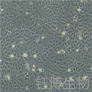 SK-OV-3/DDP（人卵巢腺癌順鉑耐藥性細(xì)胞）YB-71524HC