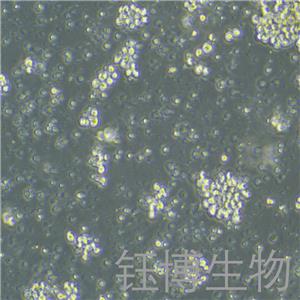 NK-92（人惡性非霍奇金淋巴瘤患者的自然殺傷細胞）YB-71530HC,NK-92
