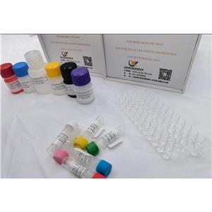 小鼠肥大細(xì)胞蛋白酶1(Mcpt1)ELISA試劑盒,Mouse Mcpt1 (Mast cell protease 1) QuickTest ELISA Kit
