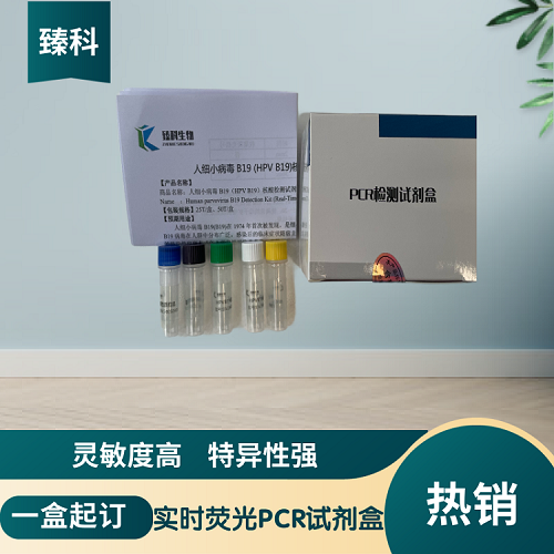 禽流感通用/H7亞型（AIV-U/AIV-H7）核酸檢測(cè)試劑盒