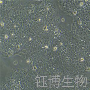 A-431（人表皮癌細(xì)胞）YB-71015HC