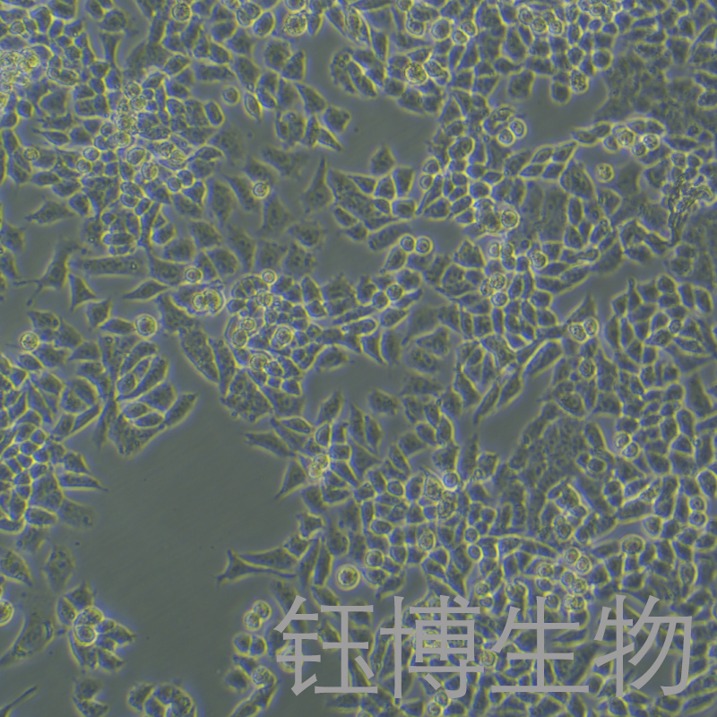 A2780（人卵巢癌細(xì)胞）YB-71013HC,A2780