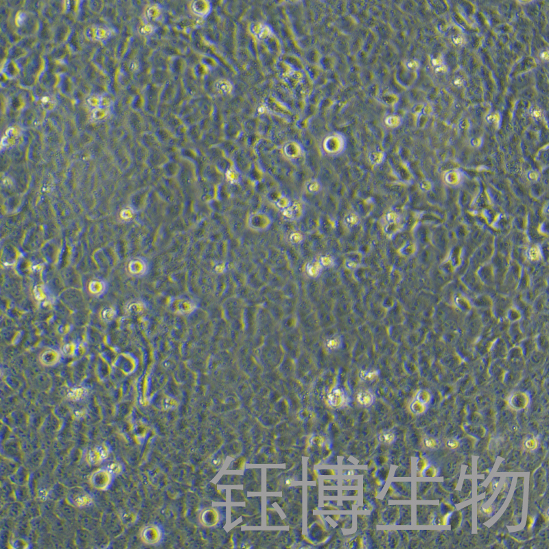 HTR-8/Svneo（人絨毛膜滋養(yǎng)層細(xì)胞）YB-71599HC,HTR-8/Svneo