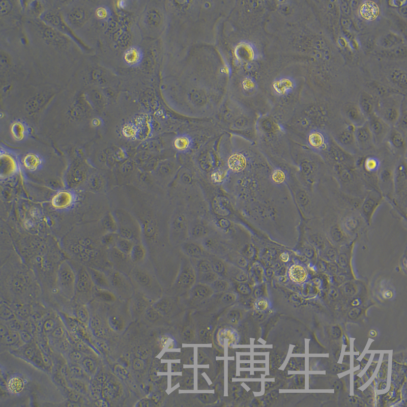 HPAF-II（人胰腺癌細胞）YB-71611HC,HPAF-II