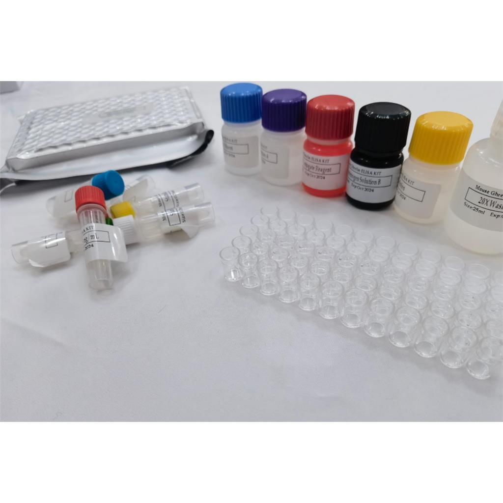 免费代测 小鼠DnaJ同源亚科B成员1(DNAJ1)ELISA试剂盒,Mouse DNAJB1 (DnaJ homolog subfamily B member 1) ELISA Kit